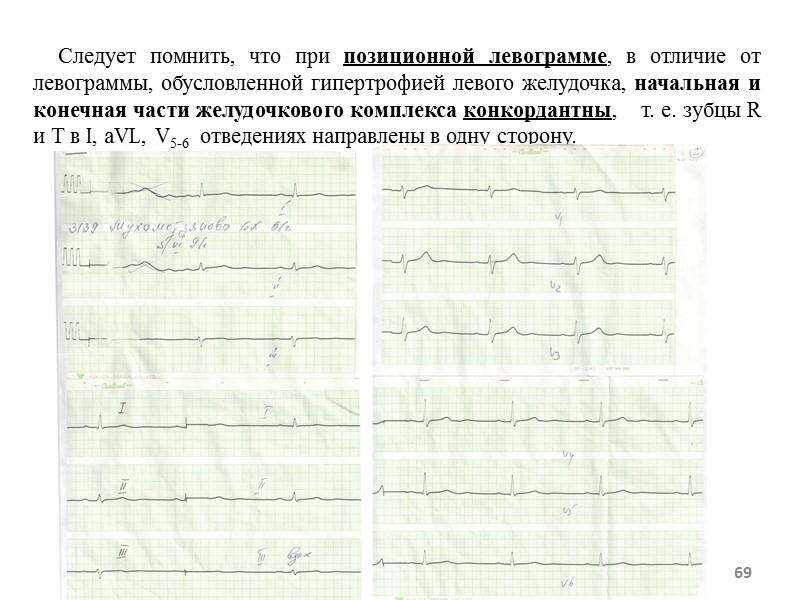 69 Следует помнить, что при позиционной левограмме, в отличие 69 Следует помнить, что при позиционной левограмме, в отличие